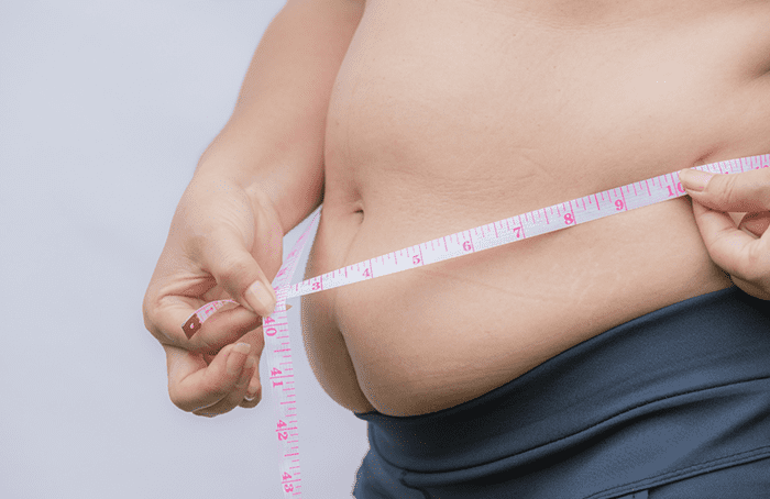 Manejo de la Obesidad y Sobrepeso