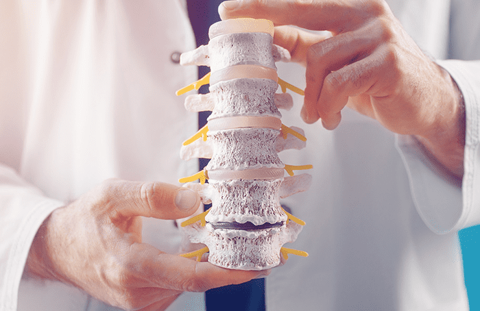 Manejo de osteoporosis